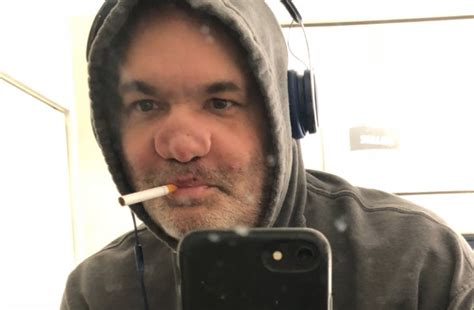 artie lange nose|Artie Lange shares picture of hideously deformed nose due to。